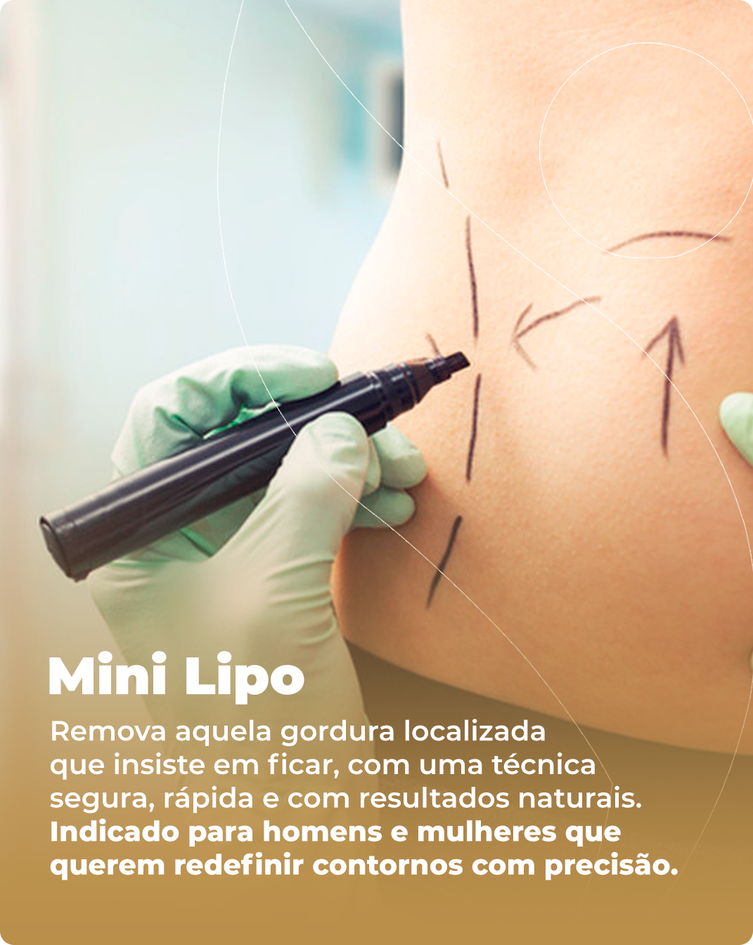 Mini Lipo